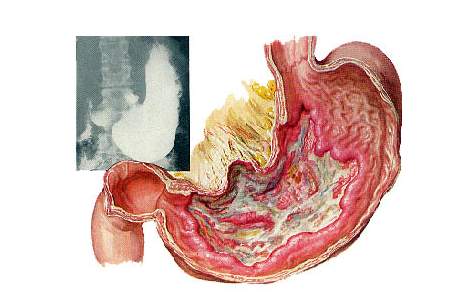 太阳成tyc7111cc官网